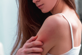 Psoriasis : du parcours de soin au parcours de vie Psoriasis : du parcours de soin au parcours de vie