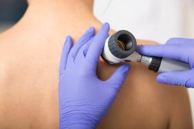 La dermatoscopie La dermatoscopie