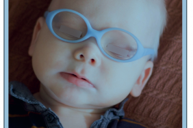 Photodermatoses de l’enfant : quand évoquer une maladie génétique ?